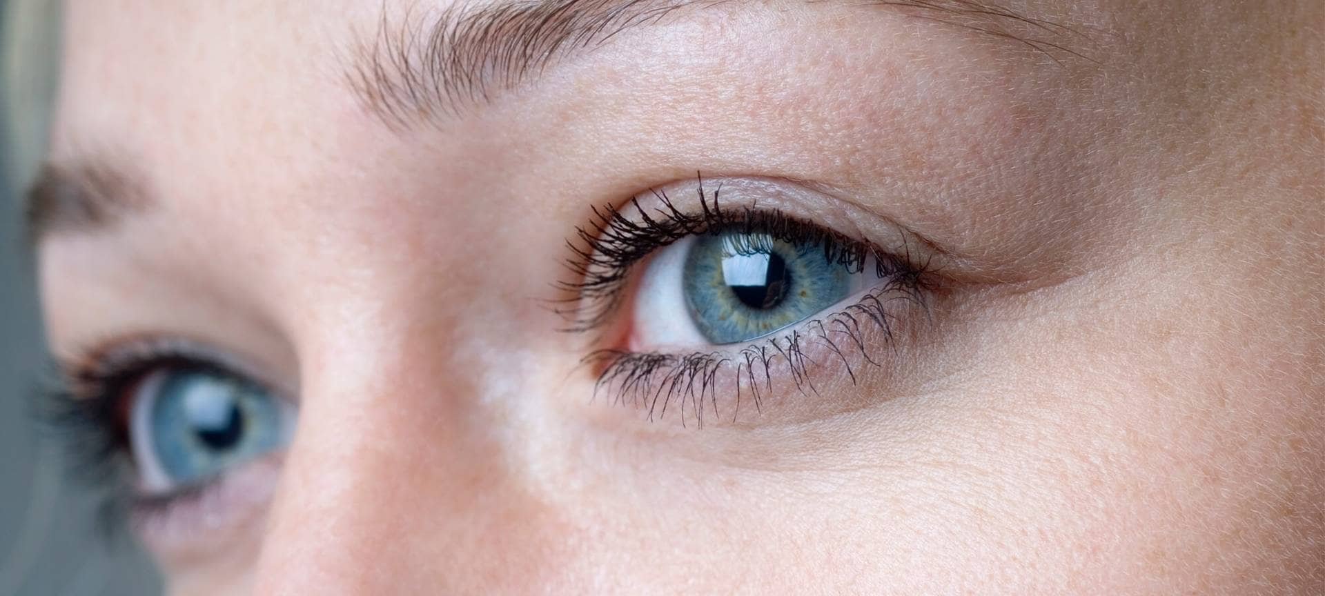 What Are The Alternatives To Injections To Plump Up My Tear Trough Article