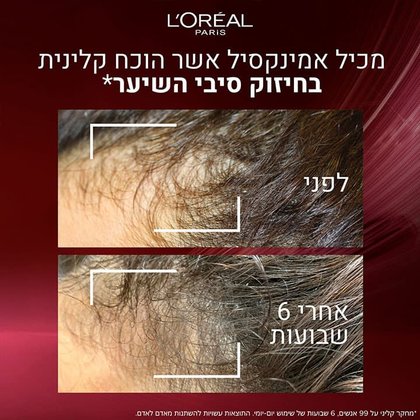 מכיל אמינקסיל אשר הוכח קלינית בחיזוק סיבי השיער. תמונת תקריב של שיער לפני ואחרי 6 שבועות של שימוש בשגרת טיפוח full Resist. מחקר קליני על 99 אנשים, 6 שבועות של שימוש יום-יומי. התוצאות עשויות להשתנות מאדם לאדם.