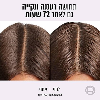 תחושה רעננה ונקייה גם לאחר 72 שעות. דוגמנית מציגה שיער לפני ואחרי שימוש במוצרי אלביב היידרה פיור. תוצאות אמיתיות ללא ריטוש.