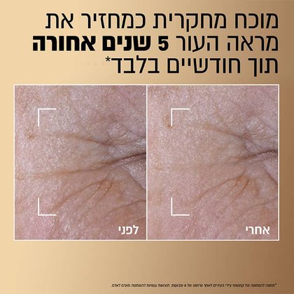 מוכח מחקרית כמחזיר את מראה עור 5 שנים אחורה תוך חודשיים בלבד. תמונה להמחשה של קמטוטי צידי העיניים לאחר שימוש של 8 שבועות. תוצאות עשויות להשתנות מאדם לאדם..